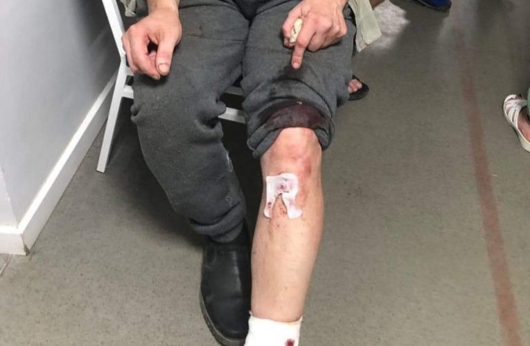 У Херсоні внаслідок ворожого обстрілу поранено чотирьох волонтерів